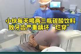 当心！小伙每天喝两三瓶碳酸饮料，致牙齿烂穿！#江苏全民目击 #920全国爱牙日视频封面