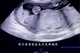 #超声影像 #即兴讲解#脐带#每天学习一点点 #医路有你 #医路前行视频封面