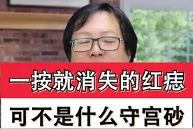 手指背上的小红点泥哈哈以为是守宫砂吗？其实是#血管瘤 #白月光与朱砂痣视频封面