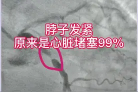 脖子发紧    原来是心脏堵塞99% @太医管家 #科普健康中国视频封面