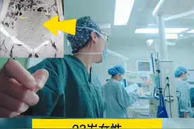 #手术室日常 #欢乐医护 快速病理诊断出来的时候，集体欢呼鼓掌，😂为了抓拍这几秒，两个手机连续记录了20分钟视频封面
