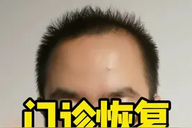 谢医生门诊恢复啦！#风湿 #类风湿 #强直性脊柱炎 #红斑狼疮 #痛风 视频封面
