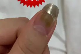指甲发霉了？#美业手艺人 ##美甲培训 #美甲分享视频封面