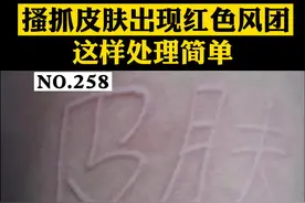 用手搔抓皮肤，就会出现红色的划痕，特别烦人，那怎么办呢？#医学科普 #皮肤 #科普 视频封面