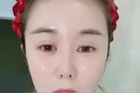 刚冲完39800的美容卡就让我知道了内幕成本 真是太窝火了，虽然效果是不错但是也不能这么翻倍吧！！视频封面