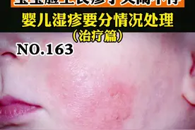 宝宝脸上起疹子，又哭又闹的，看着很心疼，看皮肤科医生如何治疗#婴儿湿疹 #湿疹 #孩子健康 #医学科普 视频封面