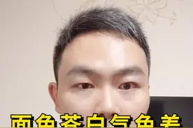 面色苍白无气色，很多人都有这个问题。#健康 #养生 视频封面