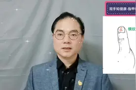 经常体力透支看这里，指甲横纹#手诊视频封面