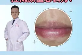 嘴角发黑，#唇周暗沉 ，这可能不是单纯的“脏”！#变美#医学科普 #女生变美 视频封面