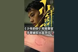 #少年的你 郑易警官手臂被#周冬雨 咬出又红又肿的牙血印！为这份敬业点赞👏视频封面