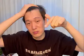 米诺对发际线有没有用！亲身测试1年的结果#拯救发际线 #秃头少女视频封面