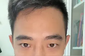 出现炭疽死亡病例，简单说一下炭疽的内容#炭疽病 #炭疽和新冠是同一等级传染病视频封面