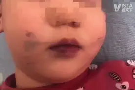 2月24日，黑龙江佳木斯一#孩子吃完蛋糕色素留脸上洗不掉 家人质疑后，店家回应：有质检报告，完全合规。视频封面
