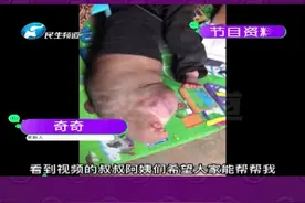 河南郑州：大象腿男孩将要迎接第二次手术，期待奇奇早日康复#河南dou知道#大象腿男孩 视频封面