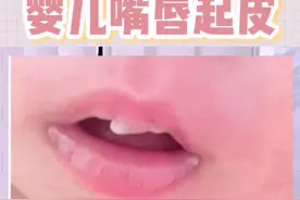 婴儿嘴唇起皮与妈妈饮食无关#宝宝 #新生儿 #婴儿 #宝妈 #孕晚期 #孕期 #宝爸 #二胎视频封面