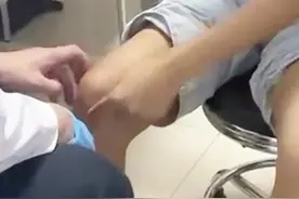 走路多了膝盖肿胀，这是怎么回事？#医学科普 #膝关节 #肿胀 #骨科孙新志 #郑大一附院 视频封面