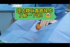 深静脉置管是麻醉医生的基本技能，能够在关键时候救患者的生命视频封面