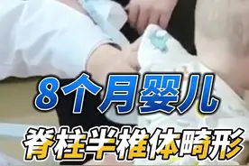 8个月的小婴儿发现脊柱半椎体，父母都很担心孩子未来出现脊柱侧弯#半椎体#脊柱侧弯 视频封面