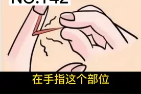 #倒刺 手上倒刺代表着缺乏维生素吗？该怎么处理，很多人都搞错了，转给身边的#家人 朋友看看吧#家庭 #干货视频封面