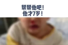 他才7岁，就因基因缺陷无法享受童年的快乐，爸爸无奈做出了一个痛苦的决定。#血液病 #基因 #求助视频封面