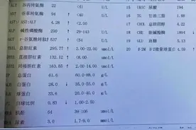 肝病患者出现酶胆分离的情况要注意是病情加重的表现！#山东肝病科马瑞萍医生 #肝硬化 #医学科普 视频封面
