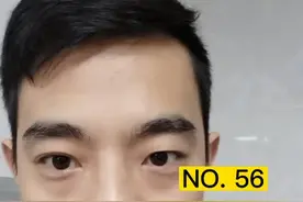 我家放了好几天的甘蔗，发红发霉了，不能吃了，千万别心存侥幸，甘蔗不值几个💰！#全民健康计划 @河豚健康视频封面