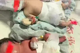 #福建 一双胞胎肤色竟一红一白？！#产房视频封面