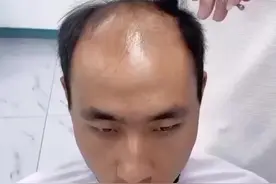 脱发严重？头发稀疏？试试这款育发液，早晚喷一喷，#仁和匠心育发液 #仁和育发液 #育发液 #防脱育发 #护发养发 视频封面