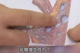 乳腺增生不用怕，两个穴位帮你缓解疼痛#医学科普视频封面