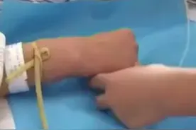 医院里必须天天都做的技能，我们一起来看下，如何快速找准血管，一针见血#热门 #护士懂护士 #实习护士 #输液中 #静脉输液 #扎针 #实习护士的一天 #护师视频封面