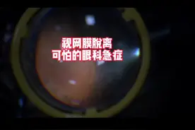 眼睛里边是什么样的？一起来看一看吧。顺便能详细了解一下视网膜脱离是怎么回事。#知识先锋计划 #医学科普 视频封面