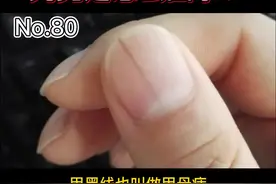 指甲上长了一条黑线，究竟是怎么回事呢？不要自己再在网上乱查，这条视频告诉你 #指甲  #甲母痣  #手视频封面