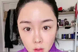 fotona4D做完一周了，确实有效果，钱没白花，纯分享不推荐医院！视频封面