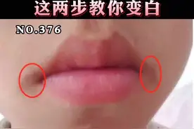 嘴角黑黑的，蔡医生教你这两步变白！#科普 #唇周黑#皮肤 视频封面