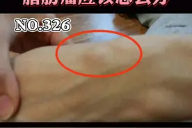 皮肤里长了软软的小肉球，是健康出现了问题吗？脂肪瘤可以这么办#皮肤 #科普 视频封面