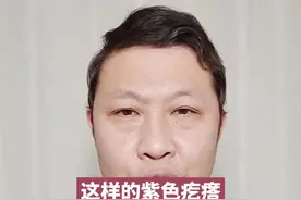 孩子屁屁旁边的紫色疙瘩是什么#育儿 视频封面