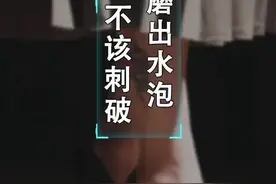 磨出水泡，该不该刺破？#冷知识 @抖音短视频视频封面