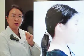 #头痛#科普知识 #健康 @抖音短视频 视频封面