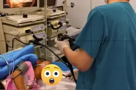#异嗜症 4岁孩子，吃头发，关注儿童心理健康视频封面