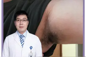 考考你的眼力，评论区讨论一下第三个是什么问题？#樊哥撩皮肤 #软纤维瘤 #腋下发黑 #黑棘皮病#医学科普 视频封面