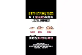 私密处长了菜花状的小丘疹，有可能是 #尖锐湿疣 ，要尽早治疗，防止扩散！#医学科普 #皮肤 #健康 #HPV  视频封面
