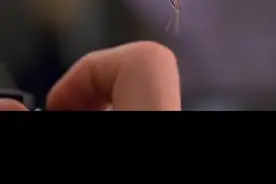 如果被蜘蛛咬到应该怎么办？#开脑洞 #涨知识视频封面