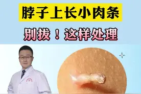 脖子上褐色小点点 小肉丁，除了影响美观，可能还会传染，怎么处理#丝状疣 #科普 #健康 视频封面
