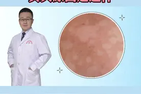 身上出现淡白色斑片，试试这样处理#医学科普 #皮肤 #汗斑 视频封面
