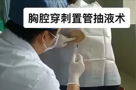实拍临床中胸腔穿刺置管抽液术#创作灵感 #胸腔积液视频封面