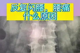 #反复腰疼#容易扭腰#健康科普3000问 #医学科普视频封面