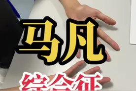 #马凡综合征  #蜘蛛指 #脊柱侧弯  #高度近视  #心血管疾病视频封面