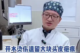 被开水烫伤头皮的小朋友，形成了大块头皮疤痕，双治疗方案（二）#头皮疤痕 #毛发种植 #小孩受伤留疤怎么办 #江华医生团队 #硬核健康科普行动视频封面