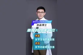 重度骨性关节炎患者，术前关节活动严重受限→术后关节功能明显改善#膝关节 #膝关节疼痛 #膝关节置换 #罗圈腿 #膝关节康复视频封面