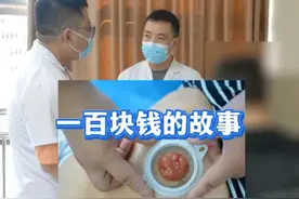 一百块钱的故事！！！ #肠穿孔手术 #结肠穿孔 #肠造瘘  #健康科普 @抖音短视频 @DOU+小助手视频封面